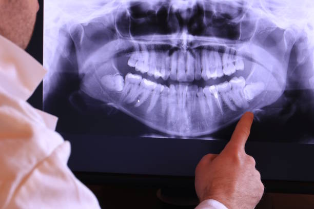 Best 24-Hour Emergency Dental Care in Pikesville, MD